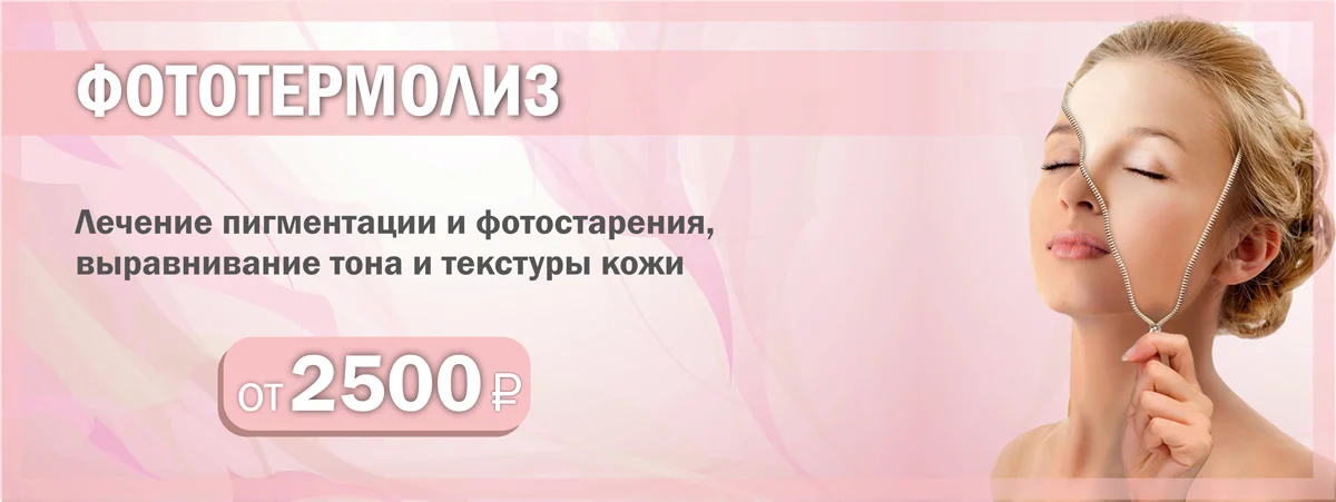 Акция на фототермолиз в Серпухове
