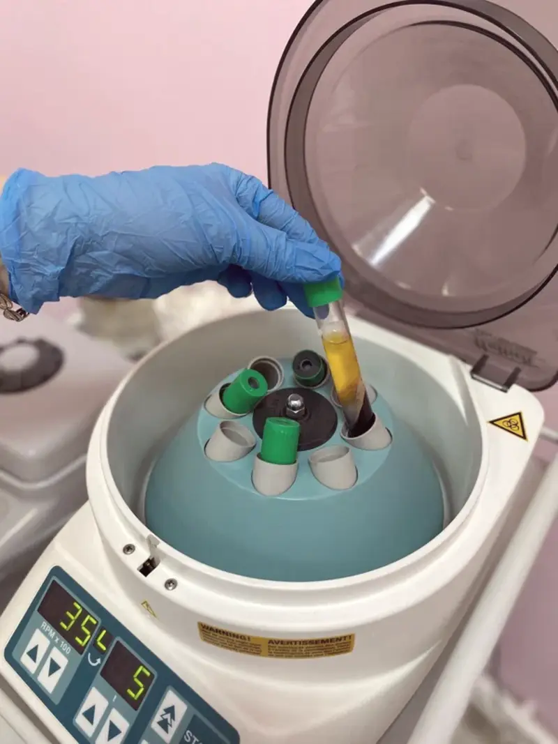 Центрифуга для приготовления плазмы Plasmoactive